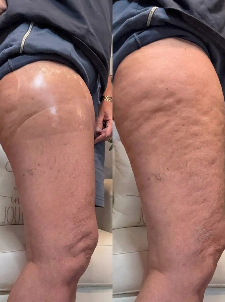 БИЕИЙГ ХЭЛБЭРЖҮҮЛЭХ LIFTING TAPE ✨